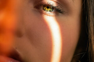 skin pigmentation